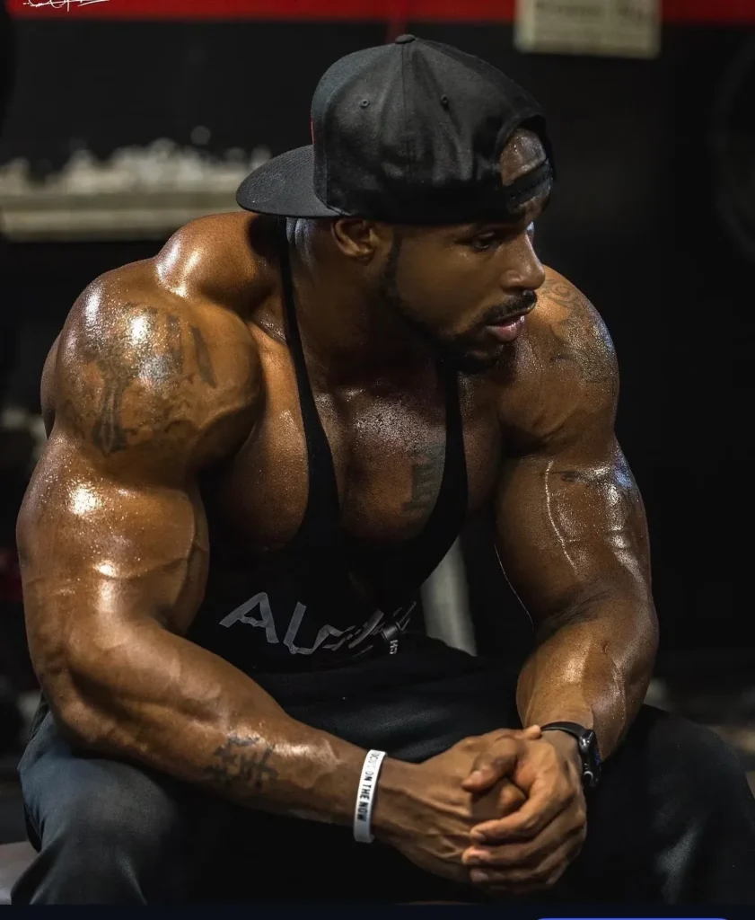 Anthony Gilkes